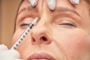 woman receiving first time botox treatment